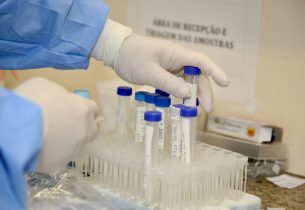 Pesquisadores desvendam como infecção por zika na gestação pode afetar cérebro do bebê